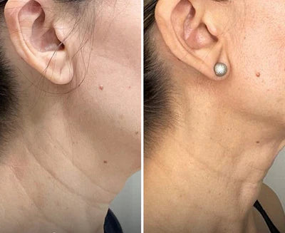 Crema Antiedad GoPure para Cuello y Escote