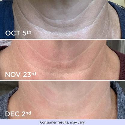 Crema Antiedad GoPure para Cuello y Escote